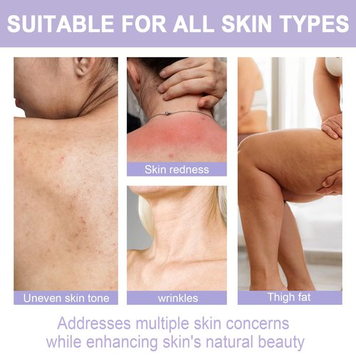 Anroha Moon Dream Overnight Toning Whip - Get Body Firming Cream for Women - Age Defying Lift and Frim Cream Helps Target the Appearance of Loose Skin On the Body 6.8 Fl oz