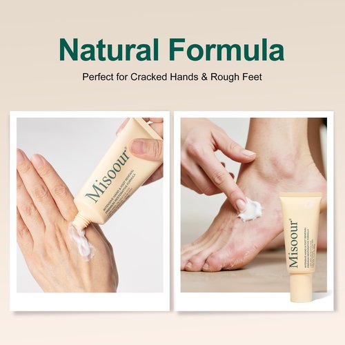Misoour 25% Urea Cream with 2% Salicylic Acid & 5% AHA + Aloe Vera, Moisturizer for Dry, Rough Skin, Helps Soften Cracked Heels, Elbows, Hands, Non-Greasy Formula (2.12 oz Tube)
