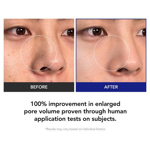 35% Smaller Pores & 32% Reduced Pore Area – Improves Skin Texture by 8% – Soothes, Hydrates & Brightens with CICA Exosomes, AHA/BHA/PHA & Fruit Enzymes – Korean Skincare Favorite Toner Pad Kioskin