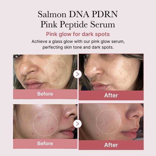 medicube Salmon DNA PDRN Duo for Beginner: Salmon DNA PDRN pink collagen jelly gel mask (4ea) and Salmon DNA PDRN Pink Peptide Serum, Pink glow serum | Holiday Stocking Stuffers