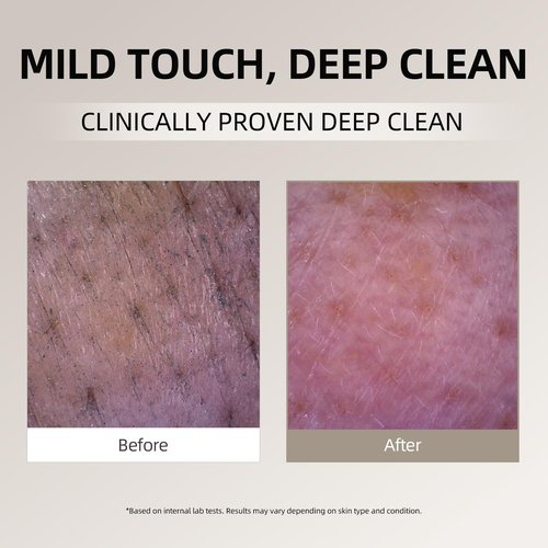 DEEOM Real Yam Brightening Cleanser, Gentle Foaming Face Wash for Sensitive Skin with Rice Water, Hydrating & Deep Pore Cleansing, Korean Skincare, 6.76 oz