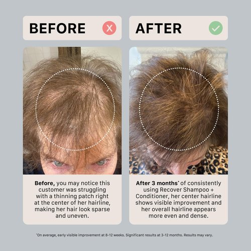 ACTIIV Recover Thickening Conditioner (Unisex) | Supports Optimal Hair Care and Recovery, Strengthens & Hydrates, Promotes Thicker Fuller Hair, Plant-Based, Color-Safe, All Hair Types, 215 mL / 7 oz