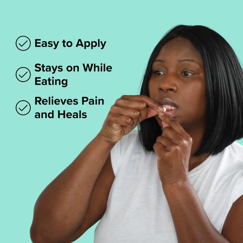 Dentemp Canker Cover - Canker Sore Medicine Pain Reliever - Canker Sore Treatment to Relieve Canker Pain, Mouth Sores & Mouth Irritation - Fast Acting Canker Sore Relief Tablets for Adults (24 Count)