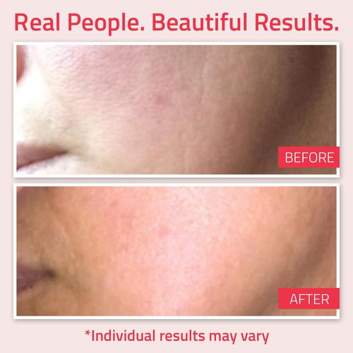 YEOUTH Retinol Cream for Face, Retinol Face Moisturizer for Women and Men with Hyaluronic Acid and Green Tea, Night Moisturizer for a Smoother Appearance 2oz