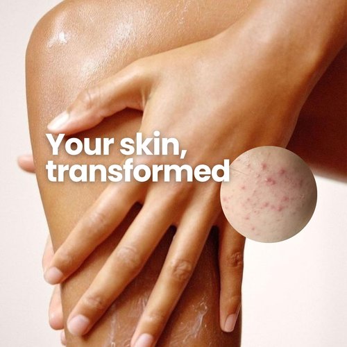 Olivia Aurora Butt & Thigh Scrub – Smooth & Hydrating Exfoliant for Legs and Glutes – Prevents Ingrown Hairs, Razor Bumps & Dark Spots – No Sugar, Vegan – 8 oz