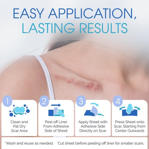 Medical Grade Silicone Scar Sheets - Silicone Scar Tape for Surgical Scars - Durable and Reusable Breathable Gel Sheets with Storage Case - Small 3-Inch, 8-Pack