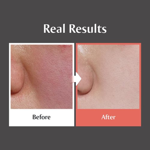 [Redence] 5% Niacinamide & Triple Hyaluronic Acid Skin Barrier Moisturizer Cream for Even Tone, Deep Hydration & Sensitive Skin Care, 1.69 fl oz
