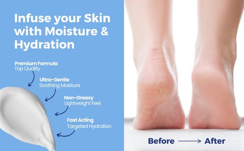 PodiPharm UREBALM25 500mL Ultra Moisturising Cream with 25% Urea For Cracked, Dry or Rough Skin UREA BALM