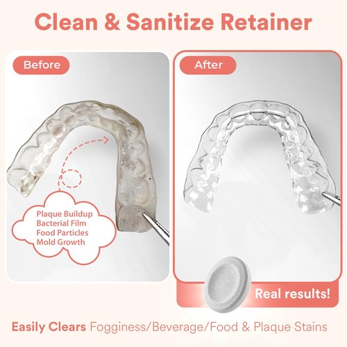 Weiss Naturals Retainer Cleaning Tablets, Invisalign Cleaner, Remove Stains, Odors & Plaque, Night Guard Cleaner PERSULFATE & DYE-FREE 2-Month Supply, Denture Cleaners, 60 Tablets