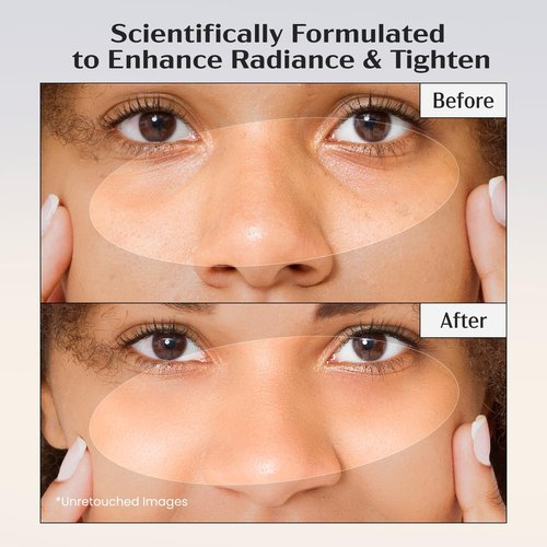 Lanmeri Ceuticals 15% Vitamin C + E Ferulic Serum: Vitamin C Serum for Face with Vitamin E, Ferulic Acid – Antioxidation, Radiance & Hydration – for Visibly Dull or Uneven-Looking Skin (1 fl oz)