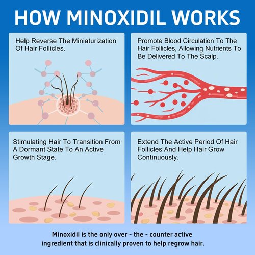 6 Packs, 5% Minoxidil with Biotin, Hair Growth Treatment, Minoxidil Hair and Beard Growth Oil, Minoxidil for Men and Women, Supports Thicker and Fuller Hair & Beard (12 fl oz, 6 Month Supply)