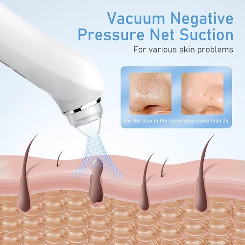 Facial Pore Blackhead Remover Vacuum, 1080P Camera Blackhead Remover, 20x Zoom, 8 LEDs ＆ 3 Suction Modes, 800mAh Battery & USB - 6 Heads Pore Cleaner Kit for Women&Men(Blue)