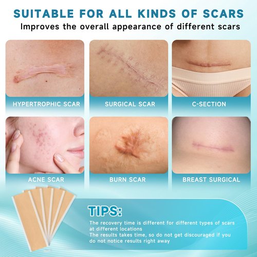 Silicone Scar Sheets, Silicone Scar Tape(5.7" x 1.57"10 Pcs) Silicone Scar Strips, Professional Scar Removal Sheets for Surgical Scars, Keloid, C-Section, Burn et