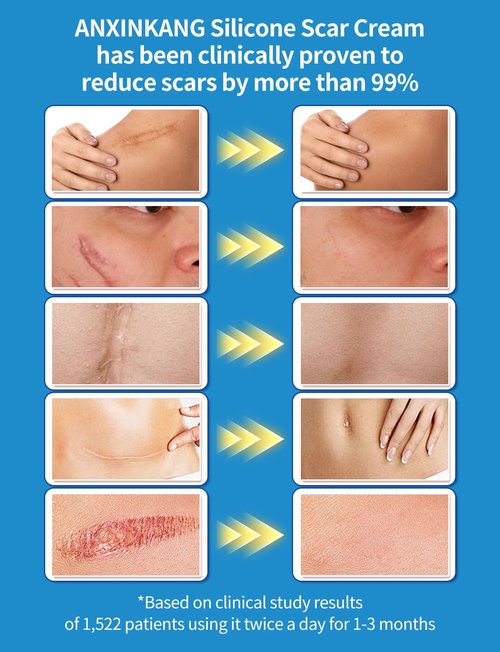 Silicone Scar Gel, Advanced Scar Cream treating for New and Old Scars, Surgical Scars, Burn Scars, Stretch Marks, Acne Scars, Dark markings, Keloid Removal 0.70 oz (2tube)