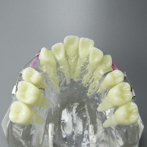 Smile1000 Dental Malocclusion Orthodontic Treatment Teeth Model with Metal Brackets Wires Colorful Ties Chains and Hoops M3005