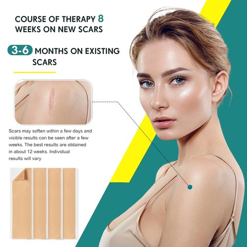 Silicone Scar Sheets, Silicone Scar Tape(5.7” x 1.57” 10 Pcs), Scar Removal Away Strips for Surgical Scars, Keloid, C-Section, Burn et
