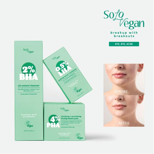 SoloVegan LHA Serum + Moisturizer | Hydrating, Moisturizing, Vegan Korean Skincare for Sensitive, Acne-Prone Skin (Facial Serum, 1.62 fl.oz)