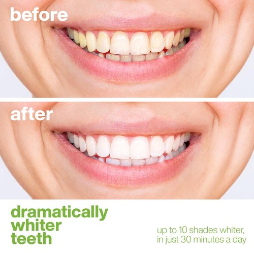 AquaSonic Professional Teeth Whitening Strips - Enamel Safe Teeth Whitening with Hydrogen Peroxide - Easy to Use, Non-Slip, Affordable & Effective (Spearmint)