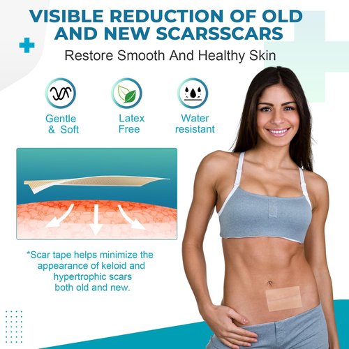Silicone Scar Sheets, Silicone Scar Tape(5.7" x 1.57"10 Pcs) Silicone Scar Strips, Professional Scar Removal Sheets for Surgical Scars, Keloid, C-Section, Burn et