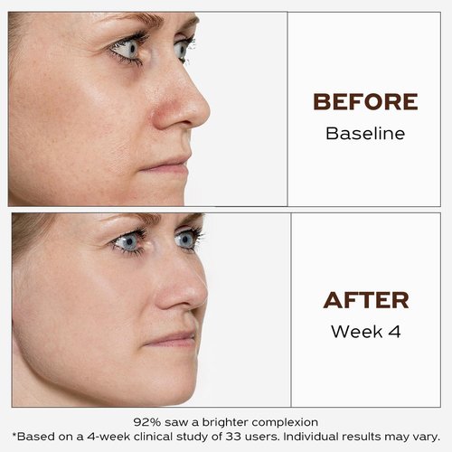 GO MAY Face Brightening Serum | 30% Vitamin C Serum | Anti-aging Serum for Face | Prevention of Future Dark Spots | 1Fl.Oz