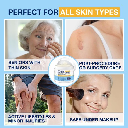 PHARMBANNER Arnica Bruise Cream Extra Strength – Fast-Acting Arnica Montana with Vitamins K, C & E for Bruising, Swelling, Discoloration & Thin Skin – Hydrating Moisturizer for Face & Body – 4 oz