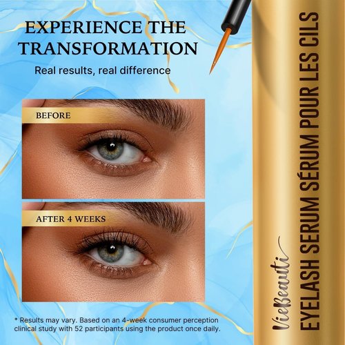VieBeauti Lash Serum for Eyelash Growth: Eyelash Growth Serum with Advanced Formula to Boost Longer Fuller and Thicker Looking Lashes - Vegan & Cruelty-Free for Sensitive Eyes 5-Month Supply - 5 ML