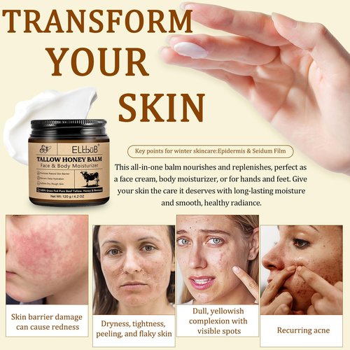 ELBBUB Whipped Tallow Cream for Face & Body - 100% Grass-Fed Beef Tallow, Natural Honey & Beeswax Moisturizer, Deep Hydration & Nourishment, Oil-Free & Unscented, Fast Absorbing