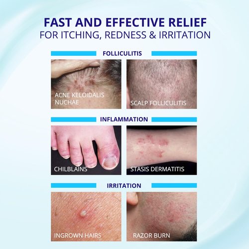 TAGRID Folliculitis Treatment Cream, Ingrown Hair Treatment, Soothing Scalp, Face & Body Cream - Hydrating & Refreshing - – Ultimate Duo