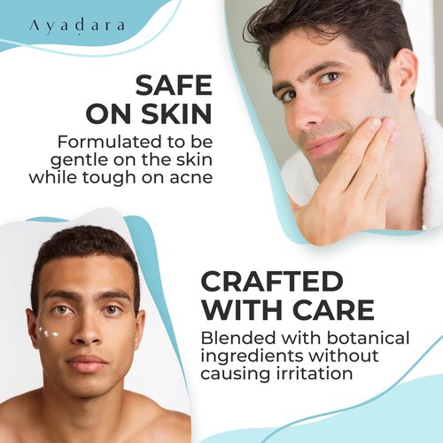 Ayadara Day & Night Cystic Acne Spot Care for Skin, Hormonal Acne Support for Daytime & Overnight, Cystic Acne Skin Balancing Formula for Face, Acne Cream with Tea Tree & Bentonite Clay, 90 Day Supply