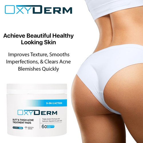 Butt & thigh Acne Treatment Pads - Exfoliating Pads to Eliminate Acne Causing Bacteria. Removes Pimples, Blemishes & Ingrown Hairs for the Buttocks & Thigh Area for Both Men & Women.