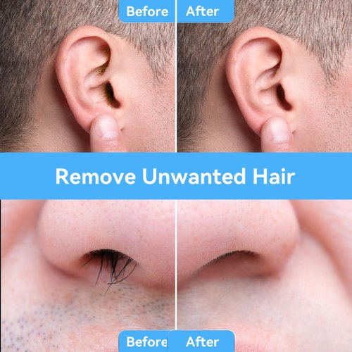 FOCTXI Nose Wax Kit - Portable Ear Nose Hair Waxing Kit for Men and Women with 100g Ｗax, 20 Applicators, 30 Nose Hair Sticks, 10 Mustache & 10 Ear Protectors, Wax Warmer Kit for Hair Removal