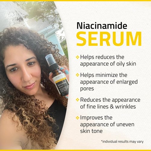 YEOUTH Niacinamide Serum for Face 10% with Hyaluronic Acid and Aloe Vera, Hydrating B3 Skin Care Face Serum for Women and Men, Hydrating Skincare Enhances the Look of Even-Toned Skin 2oz