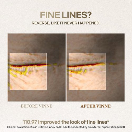VINNE Signature Bio Deep Collagen Firming Mask – Korean Hydrogel Mask w/ 5,000ppm Ultra-Low Molecular Collagen, Centella Asiatica Exosome, Niacinamide & PDRN – Skin Care Face Mask (4 Sheets, 1.41 oz)