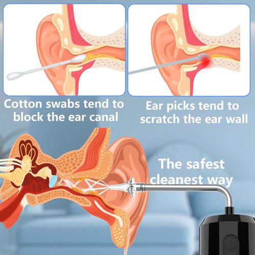 Kliburu Ear Wax Removal Kit, Electric Ear Cleaning Kit with 4 Pressure Modes, Portable Water Powered Ear Cleaner with Basin and 5 Nozzles, 4 Directional Ear Irrigation System for Adults and Kids