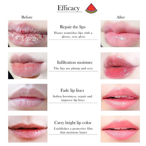 10 PCS Bee Lip Balm Honey Pot, Honey Lip Mask Bulk, Moisturizing Lip Sleeping Mask Hydrating Prevention Dry & Cracked Lip, Reduce Lip Lines and Wrinkles