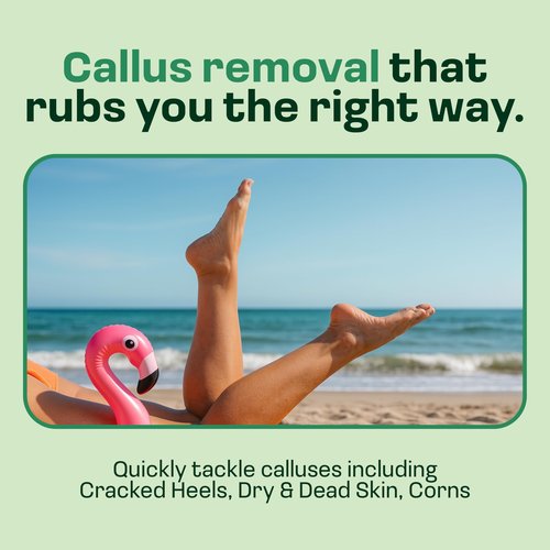 HAPPY SOLES Electric Sole Buffer Foot Callus Remover - Rechargeable Electric Foot File for Dead Dry Skin - Professional Pedicure Tool - Smooth Cracked Heels & Calloused Feet - Ultimate Self-Care Tool