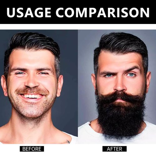 New Apolo Para Barba, Apolo Ultra Potente Estimulante De Barba, Balsamo Para Crecimiento De Barba Para Hombre,Beard Balm for Men's Beard Growth, Moisturizes & Strengthens 100 ml / 3.5 oz (2PC)