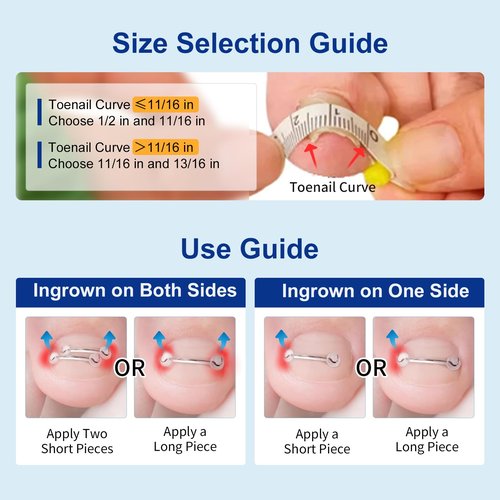 Nitinol Ingrown Toenail Corrector,at Home Ingrown Toenail Treatment,Curved Toenail Straightener,Ingrown Toe Nail Relief，Ingrown Toenail Removal Kit (1/2 In,11/16 In)