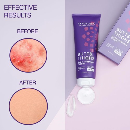 Butt Acne Cream & Razor Bump Serum – Helps Reduce the Look of Ingrown Hairs, Bumps & Redness – Post-Shave & Waxing Skin Comfort - Bundle