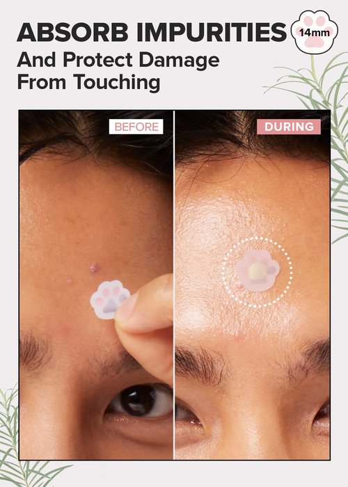 I Dew Care Hydrocolloid Acne Pimple Patch - Timeout Blemish Happy Paws | 36 Count (14mm) + Face Serum - Juicy Kitten | Purifying Power-Green Korean Skincare with Niacinamide, 1.01 Fl Oz Bundle