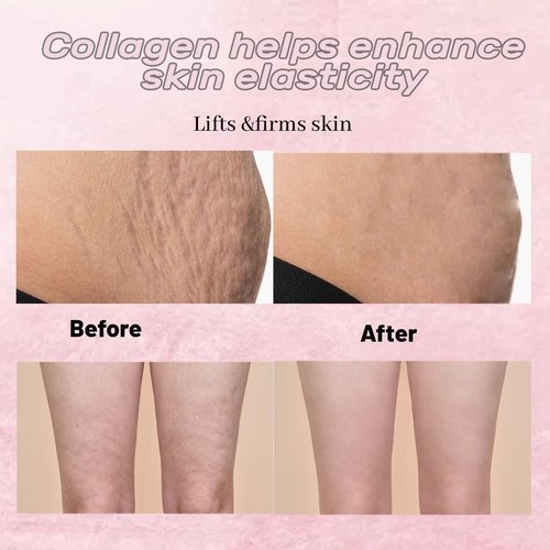 ADEUS Crema Brasileña, Cream Rosada, Multifunctional Pink Intensive Cream, Deeply Moisturizing and Firming Creams with Centella Asiatica, Seaweed and Green Tea (1)