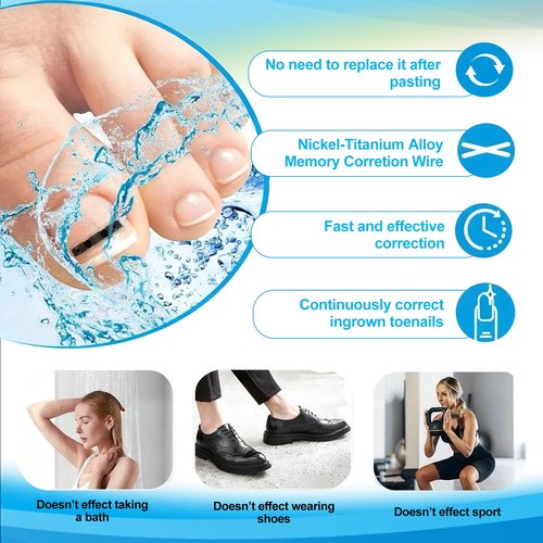 10 Pcs- Ingrown Toenail Treatment Kit with Nickel-Titanium Memory Wire, Professional At-Home Ingrown Toenail Removal kit for All Size Curve Correct, Ingrown Toenail Tools for Quick Relief.