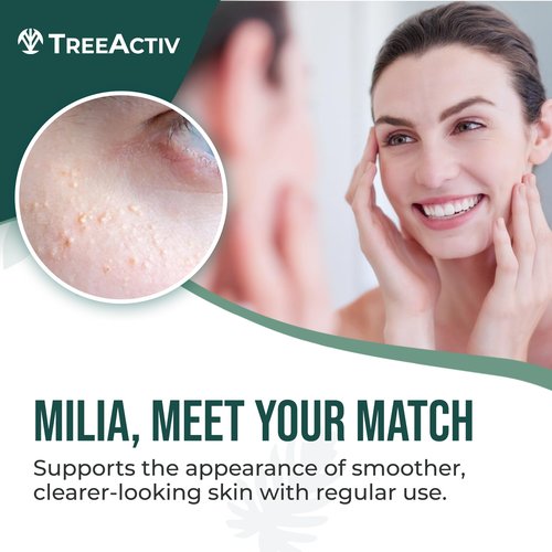 TreeActiv Milia & Acne Spot Cream 3 Items Tool Kit, Eye Milia Remover, Includes 0.5oz Overnight Milia Remover Cream with Bentonite Clay and Aloe Vera, Milia Extractor Tool Kit Acne Treat