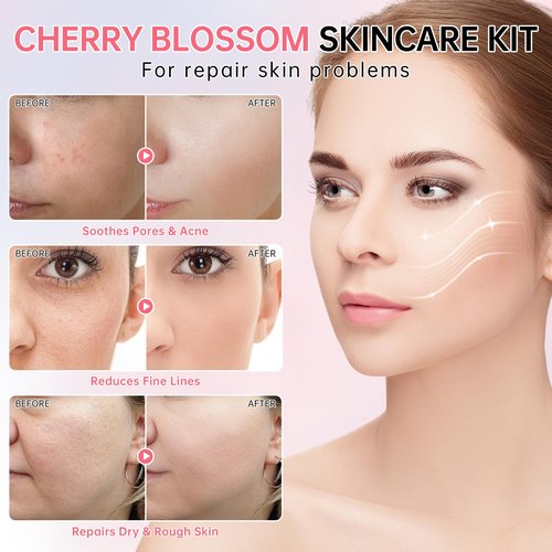 Sakura Skin Care Set for Teen Girls, Cherry Blossom Skincare Gift Set for Teens & Women, Moisturize & Repair Skin, 6 Pcs Collagen Skin Care Kits with Cleanser, Toner, Lotion, Serum, Cream & Eye Cream