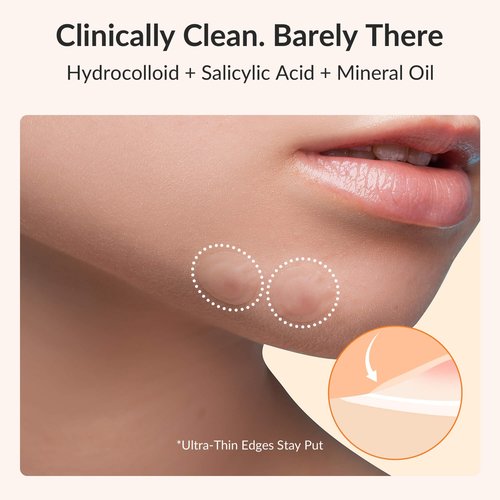 RPE Life Invisible Pimple Patches – 4 Sizes Miracle Patches for Pimples with Hydrocolloid & Salicylic Acid, Korean Acne Patches for Face, Zit Stickers, Blemish Patches, Acne Spot Dots – 144 Count