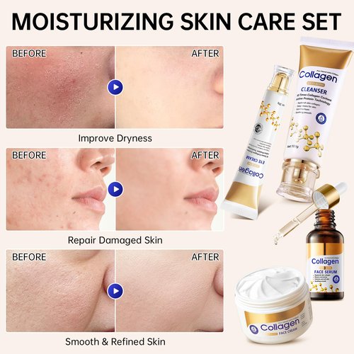 Collagen Skin Care Set, Anti Aging Skincare Set for Wrinkles & Fine Lines, Shrink Pores, Hydrate & Firm Skin, 7 Pcs Skincare Kits for Women with Cleanser, Toner, Serum, Cream, Eye Cream, 2 Pcs Masks.