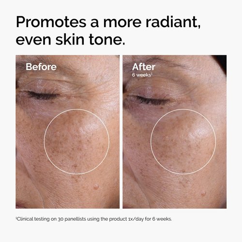 The Ordinary Glycolic Acid 7% Exfoliating Toner, Brightening and Smoothing Daily Toner for More Even-Looking Skin Tone, 8.1 Fl Oz (Pack of 2)