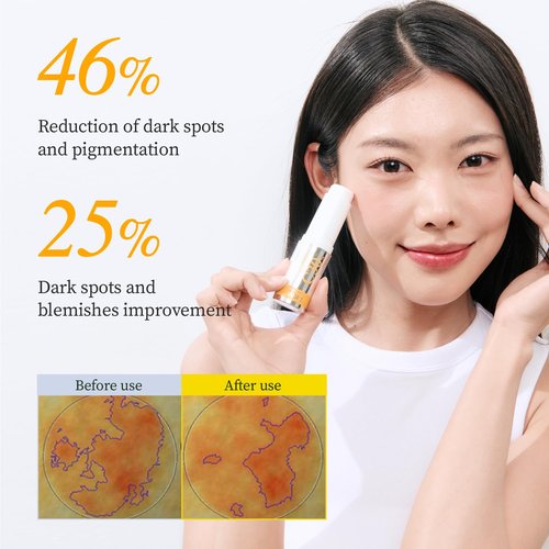 YADAH Vitamin C 30 Correcting Balm (0.35oz) – All-in-one Multi Care for Dark Spot Remover, 30% Pure Ascorbic Acid & Vitamin E for Radiant Nourished Skin, Starter & Finishing Balm and Skin Brightening