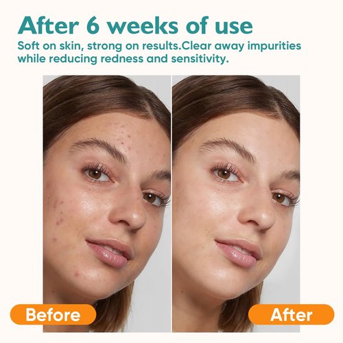 UNIMADE Face Towels, 400 Count Disposable Face Towelette for Washing Face, Skincare, Ultra Soft Facial Towel for Sensitive Skin, Lint-free Makeup Remover Dry Wipes - 8 Box
