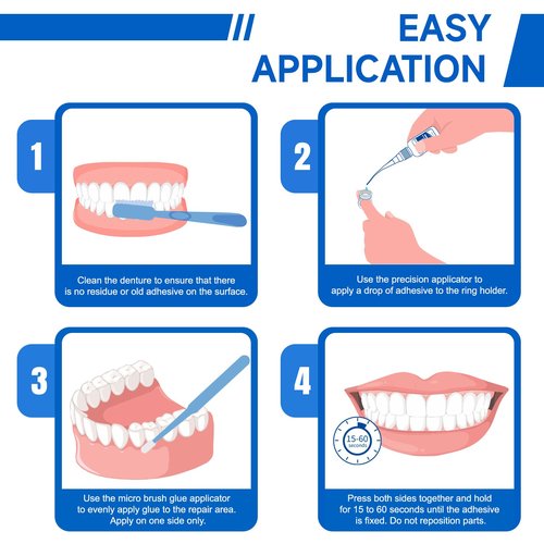 Dental Lab Denture Repair Adhesive Kit, 1oz Pro Instant Bonding Denture Glue for Repairs Cracks, Fills Gaps, Secures Loose Teeth, Safe Bonding with No Irritating Odor
